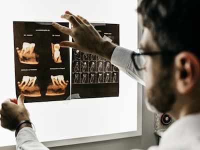 Root Canal Treatment: What to Expect