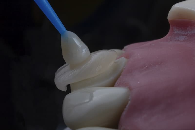Dental Implants & Crowns